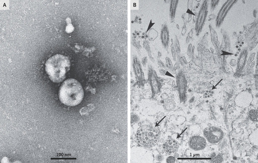 Coronavirus foto 